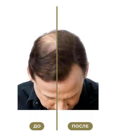 Reformawm Natural hair growth NATURAL 60 ml - Buy Online on GoSupps.com