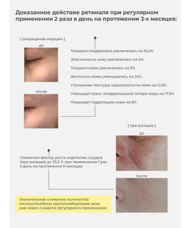 BYMOWI Belarusian anti -aging face cream with retinol - Buy Online on GoSupps.com