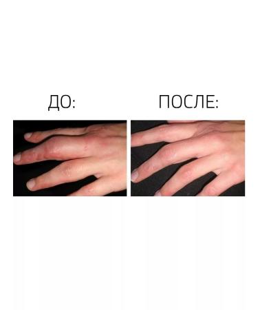 Hanson Skincare Scarfade silicone gel from scars - 30g - Buy Online on GoSupps.com