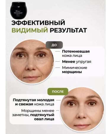 O'CHEAL Face cream moisturizing anti -aging from wrinkles - Buy Online on GoSupps.com