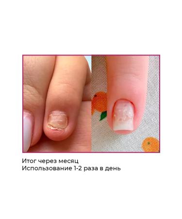 ROSILAK Professional set for the treatment and restoration of nails - Buy Online on GoSupps.com