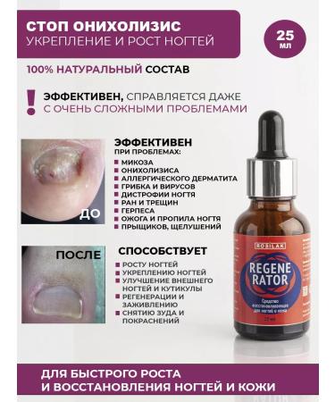 ROSILAK Professional set for the treatment and restoration of nails - Buy Online on GoSupps.com