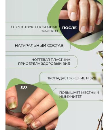 Herbal Harbor Cream ointment from nail fungus eccin - Buy Online on GoSupps.com