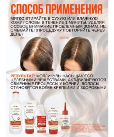 Vitex Active Hair Complex Waste Waste Waste - Buy Online on GoSupps.com