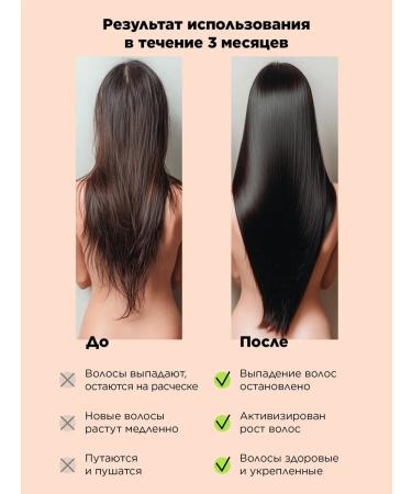 TRENDONIC Hair mask with heating pepper 400 ml - Buy Online on GoSupps.com