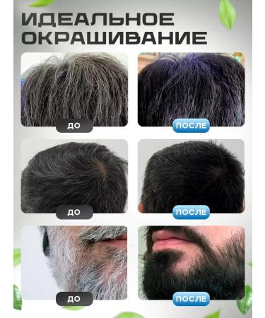 ExtraHair Black hair shampoo - Buy Online on GoSupps.com