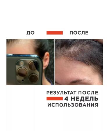 OzoneBox Hair set shampoo and mask - Buy Online on GoSupps.com