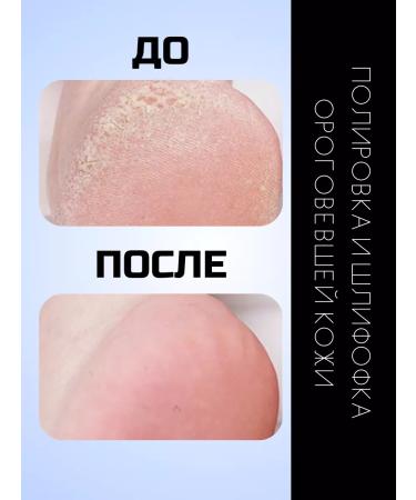 Ekabeautiful Replaceable files 100 grit for smart disk d25 - Buy Online on GoSupps.com