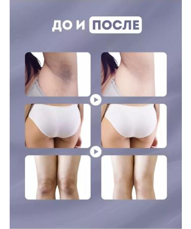 Candy Bella Whitening face cream - Buy Online on GoSupps.com