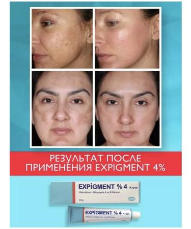 ORVA EXPIGMENT Whitening cream against pigmentation - Buy Online on GoSupps.com