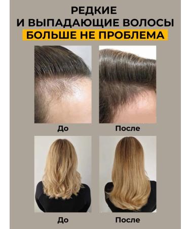 JoceJoli Hair growth serum - Buy Online on GoSupps.com