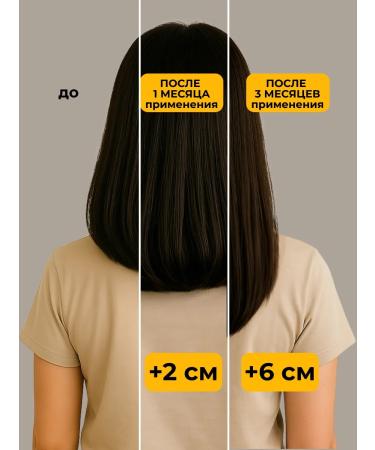 JoceJoli Hair growth serum - Buy Online on GoSupps.com