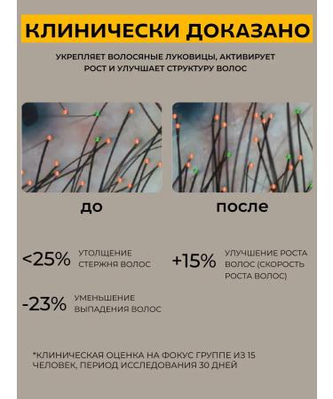 JoceJoli Hair growth serum - Buy Online on GoSupps.com