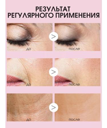 SHARY Anti -aging piling Pads 55 pcs - Buy Online on GoSupps.com