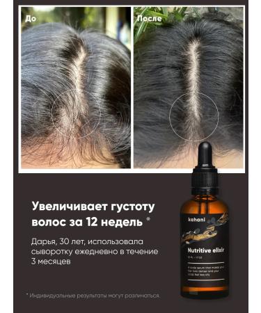 Kahani Natural serum for hair growth and from falling out - Buy Online on GoSupps.com
