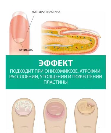 Lolocandy For nails ointment and serum from the fungus - Buy Online on GoSupps.com