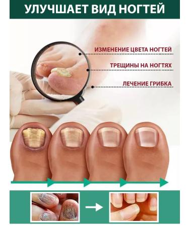 Lolocandy Ointment and whey of nails - Buy Online on GoSupps.com