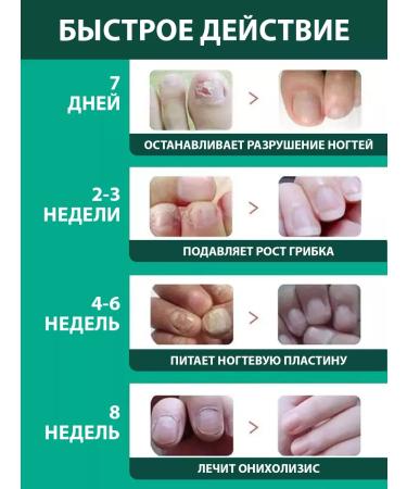 Lolocandy Ointment and whey of nails - Buy Online on GoSupps.com