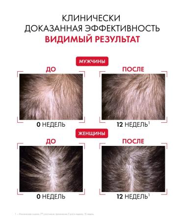 Vichy Dercos aminexil regenical serum for hair growth 90 ml - Buy Online on GoSupps.com