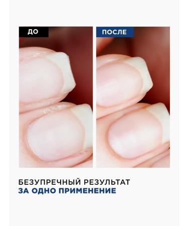 MIXIT Nail Monarchs and cuticles with handlekeepers for hand - Buy Online on GoSupps.com