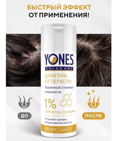 Yones Shampoo from dandruff and hair loss - Buy Online on GoSupps.com