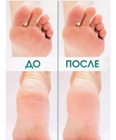 RuNail Professional Urea with urea 200 ml - Buy Online on GoSupps.com