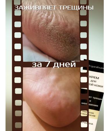 Organihuma Foot cream from cracks - Buy Online on GoSupps.com