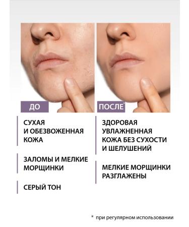 IRVIDA Moisturizing face toner for dry and combined skin - Buy Online on GoSupps.com