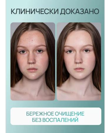 Pure Line Facial and body cream from acne acne and post -acne - Buy Online on GoSupps.com