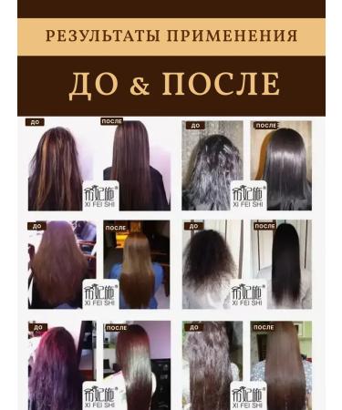 ZaKrasoty Anti-hair loss shampoo - Buy Online on GoSupps.com