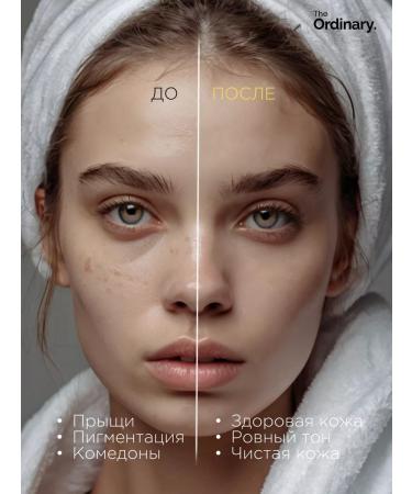 The ordinary Wederal with retinol 1% - Buy Online on GoSupps.com