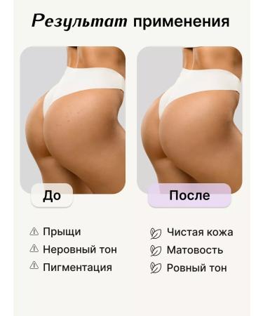 Apoterm Body milk+ serum acne - Buy Online on GoSupps.com