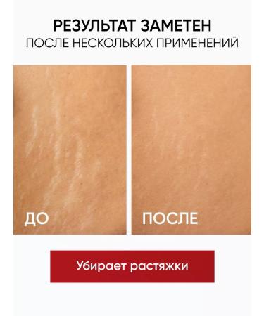 COSMEYA Anti -cellulite body scrub for weight loss - Buy Online on GoSupps.com