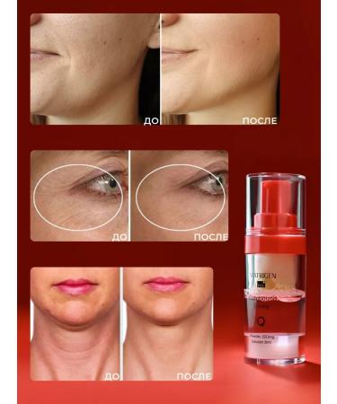 Matrigen Wheezero for the face. Korea. Q10 - Buy Online on GoSupps.com