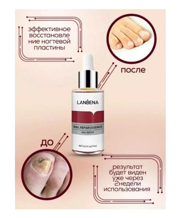 SALE Essence from nail fungus - Buy Online on GoSupps.com