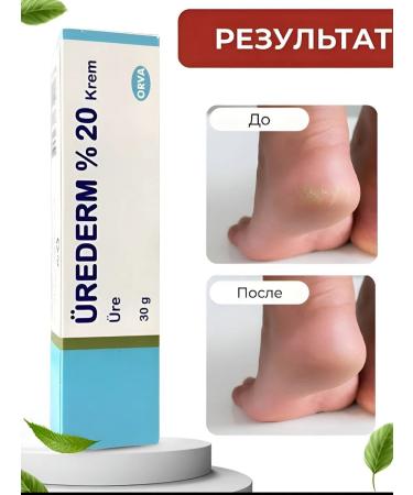 Urederm Feet cream from cracks on heels - Buy Online on GoSupps.com