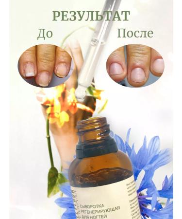 POLLYLOOK Nail strengthening tool 2 pcs 30 ml - Buy Online on GoSupps.com