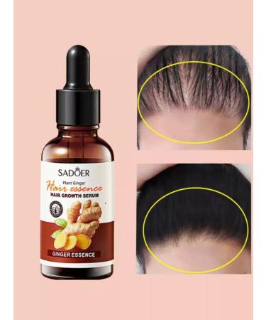 Hits Leg Hair growth serum hair loss - Buy Online on GoSupps.com