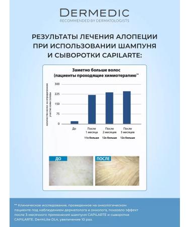 DERMEDIC Whey-therapy against hair loss Capilarte 150ml - Buy Online on GoSupps.com