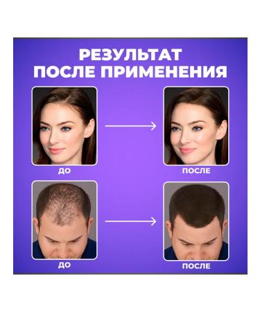 Toppik Thickener for hair and beard powder - Buy Online on GoSupps.com