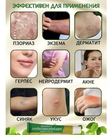 SEDOSA Miracle ointment from psoriasis of eczema dermatitis Herbal Cream 15g - Buy Online on GoSupps.com