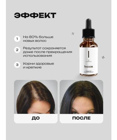 lvcos Hair growth serum on the head - Buy Online on GoSupps.com