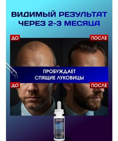 Great Solutions Lotion 5% for hair growth and beard - Buy Online on GoSupps.com