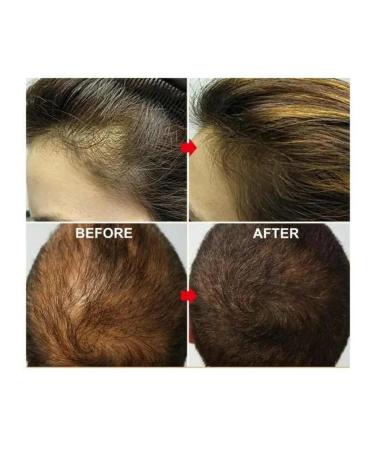 BEAUTY-LIFE88 Hard hair shampoo for growth from falling out - Buy Online on GoSupps.com