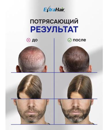 ExtraHair Serum remedy for hair loss Extra HAIR MECOROLLER - Buy Online on GoSupps.com