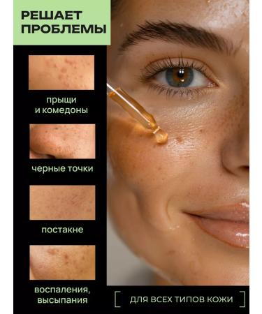 QCOS Facial serum from acne and acne - Buy Online on GoSupps.com