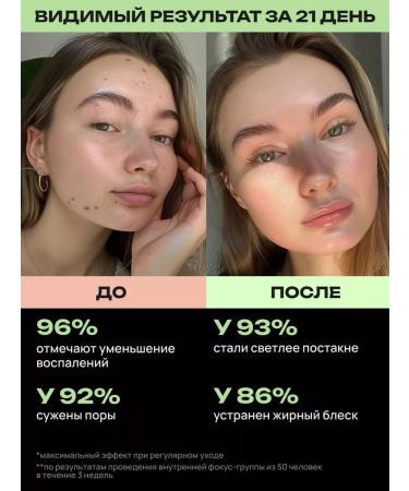 QCOS Facial serum from acne and acne - Buy Online on GoSupps.com