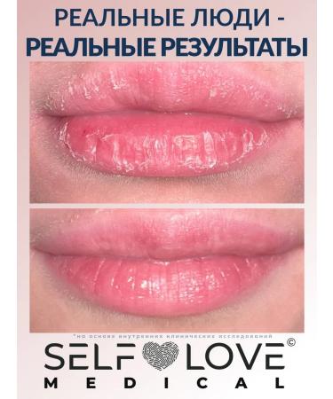 SelfLoveMedical Lip scrub exfoliating moisturizing - Buy Online on GoSupps.com