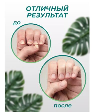 Mycomizol Nail fungus cream - Buy Online on GoSupps.com