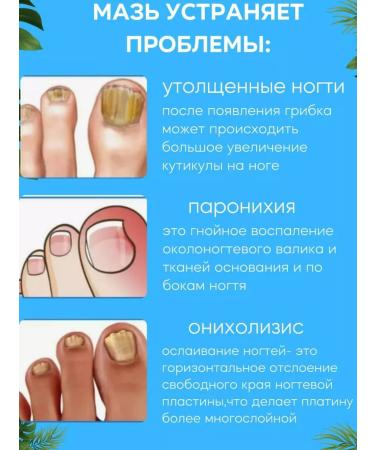 Boston An ointment from an ingrown nail - Buy Online on GoSupps.com